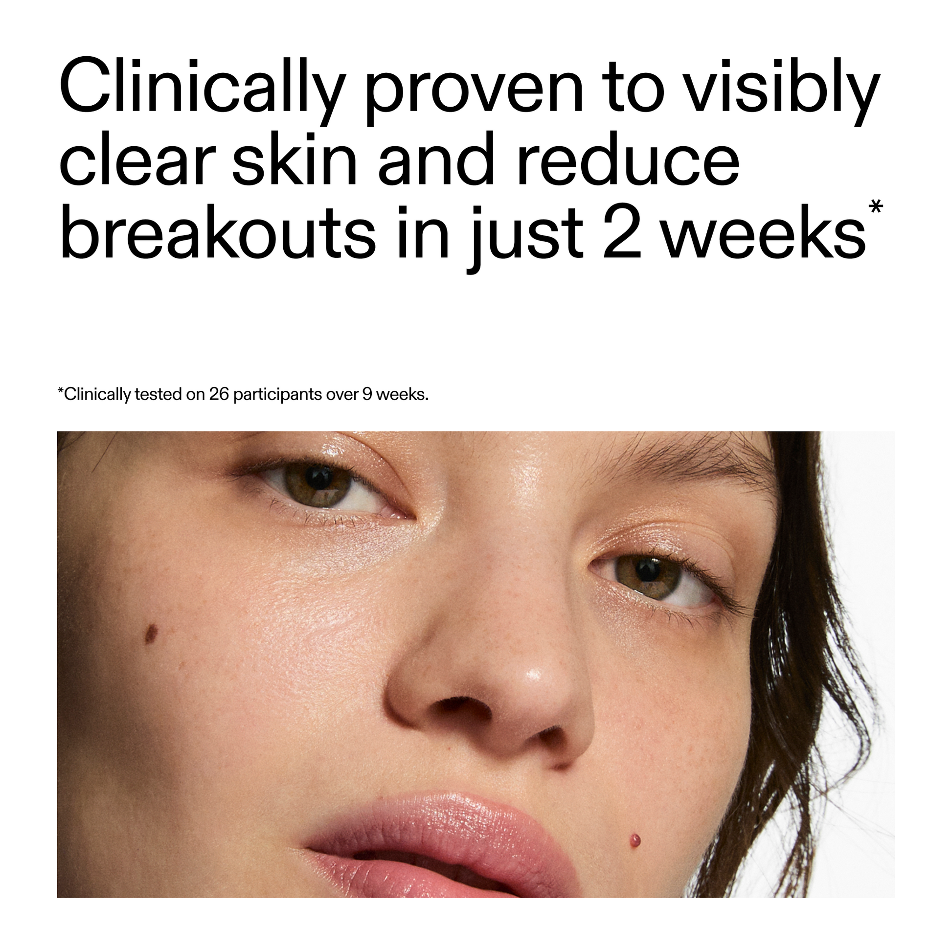 360-acne-clearing-duo-m8 360_Serum_Key_Claim.png