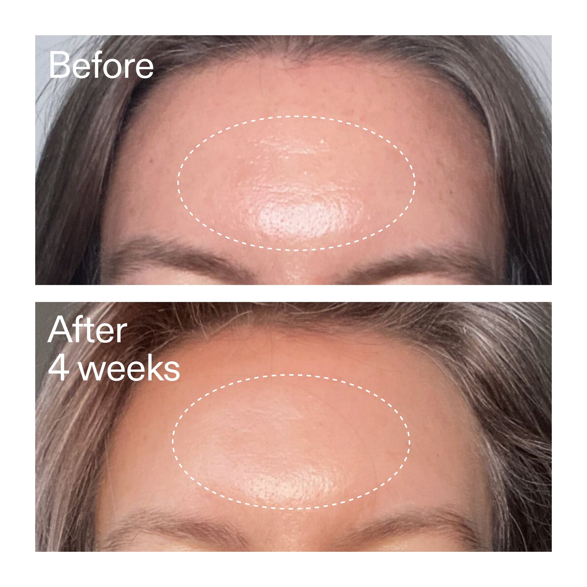 advanced-0-2-retinal-serum-duo-o2 AdvancedRetinal_BeforeAfter1_2000x2000_4e9c798a-f30e-45b8-a34a-7c4740f2f2cb.jpg