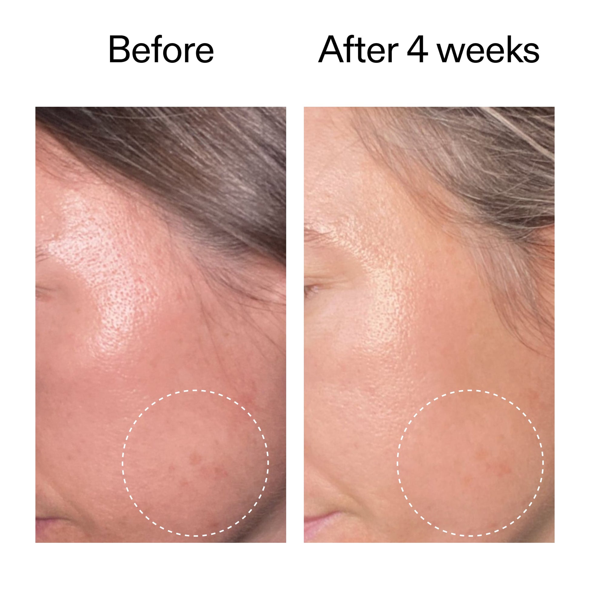 advanced-0-2-retinal-serum-duo-o2 AdvancedRetinal_BeforeAfter2__2000x2000_8ef75542-2316-4814-81ee-0f66a85912bc.jpg
