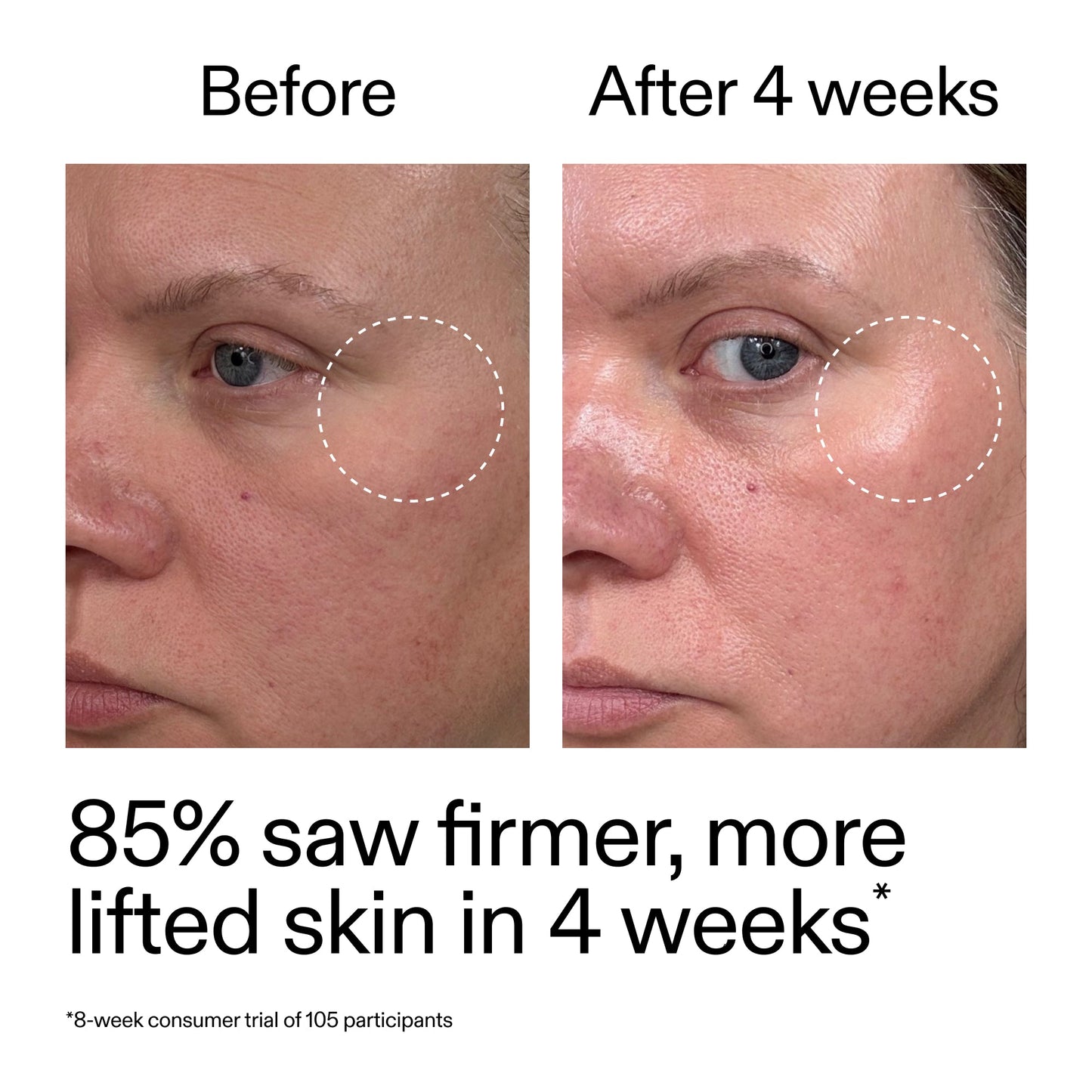advanced-0-2-retinal-serum-u6 AdvancedRetinal_BeforeAfter_Claim1_2000x2000_bcc385c4-5e73-4f1e-aba8-64267937d0d3.jpg
