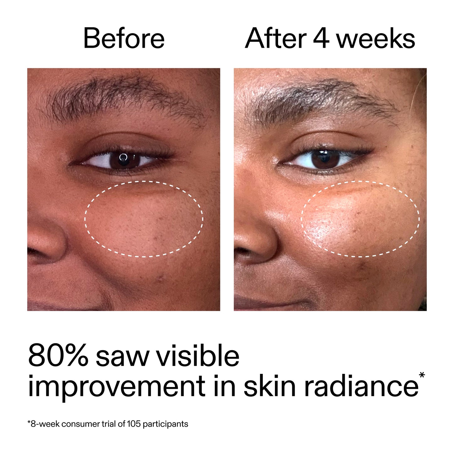 advanced-0-2-retinal-serum-duo-o2 AdvancedRetinal_BeforeAfter_Claim2_2000x2000_681b621d-8d44-4d44-9a40-89244f9b2e53.jpg