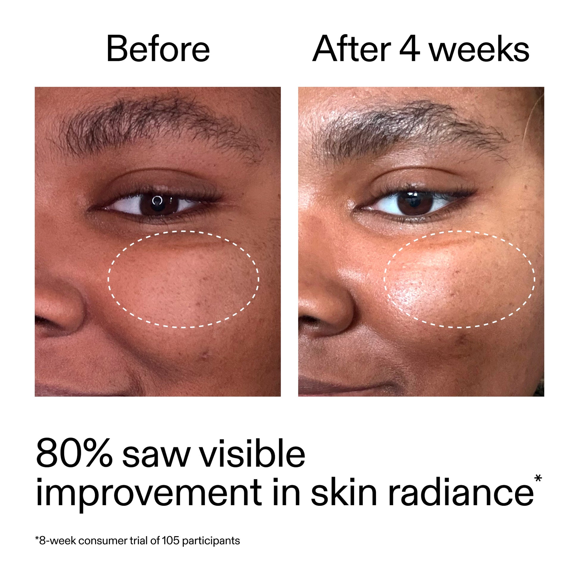 advanced-0-2-retinal-serum-duo-o2 AdvancedRetinal_BeforeAfter_Claim2_2000x2000_681b621d-8d44-4d44-9a40-89244f9b2e53.jpg
