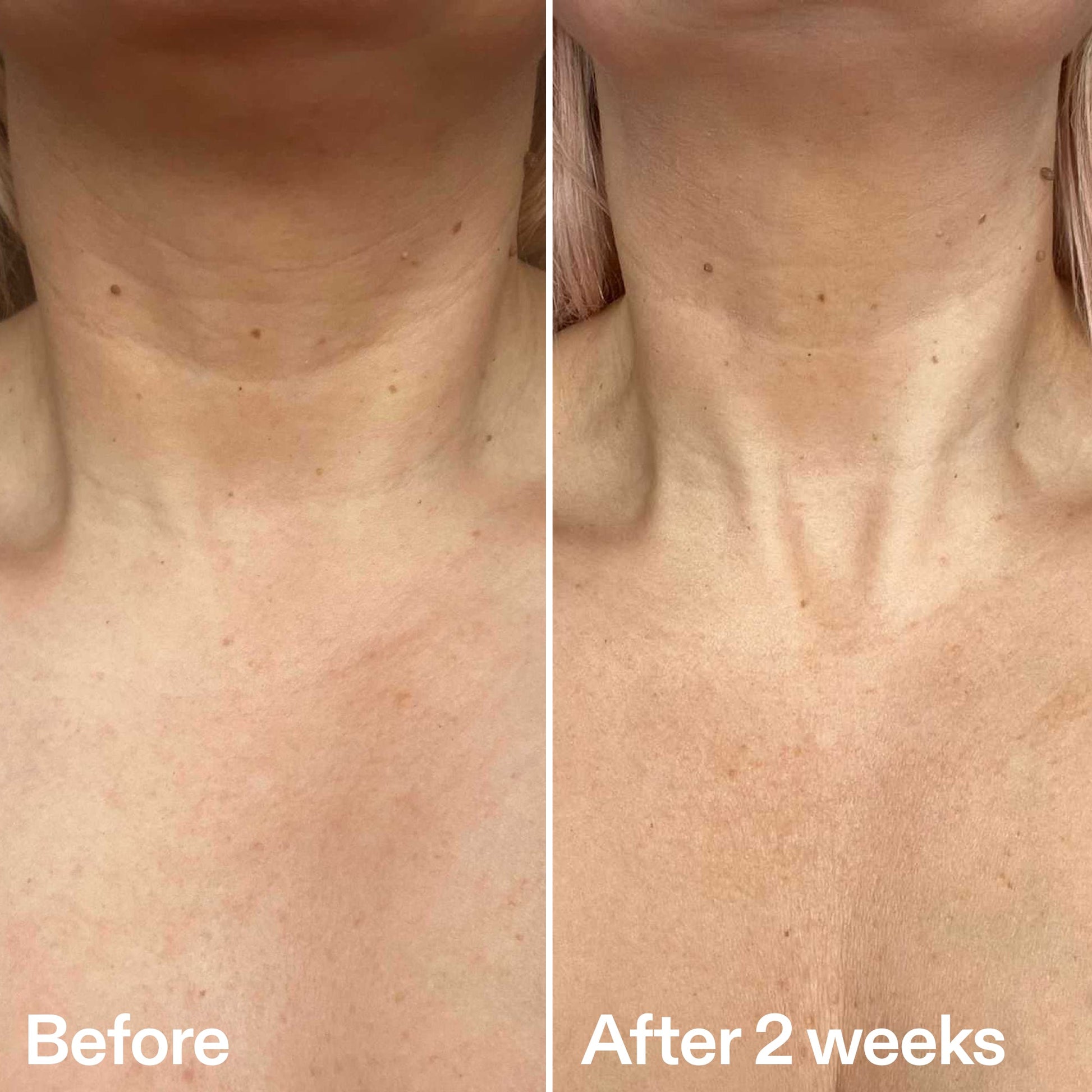 bio-active-neck-lift-stick-p9 B_A_2.jpg