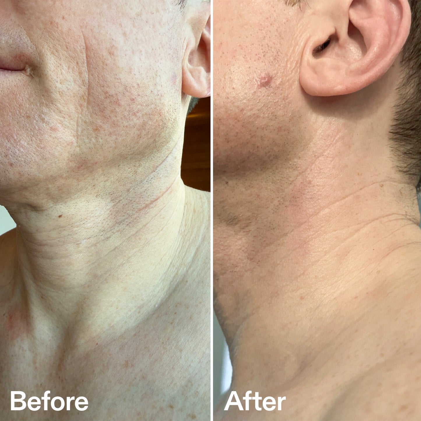 bio-active-neck-lift-stick-p9 B_A_afa2743e-b8e2-4504-92f4-e281cb6cf759.jpg