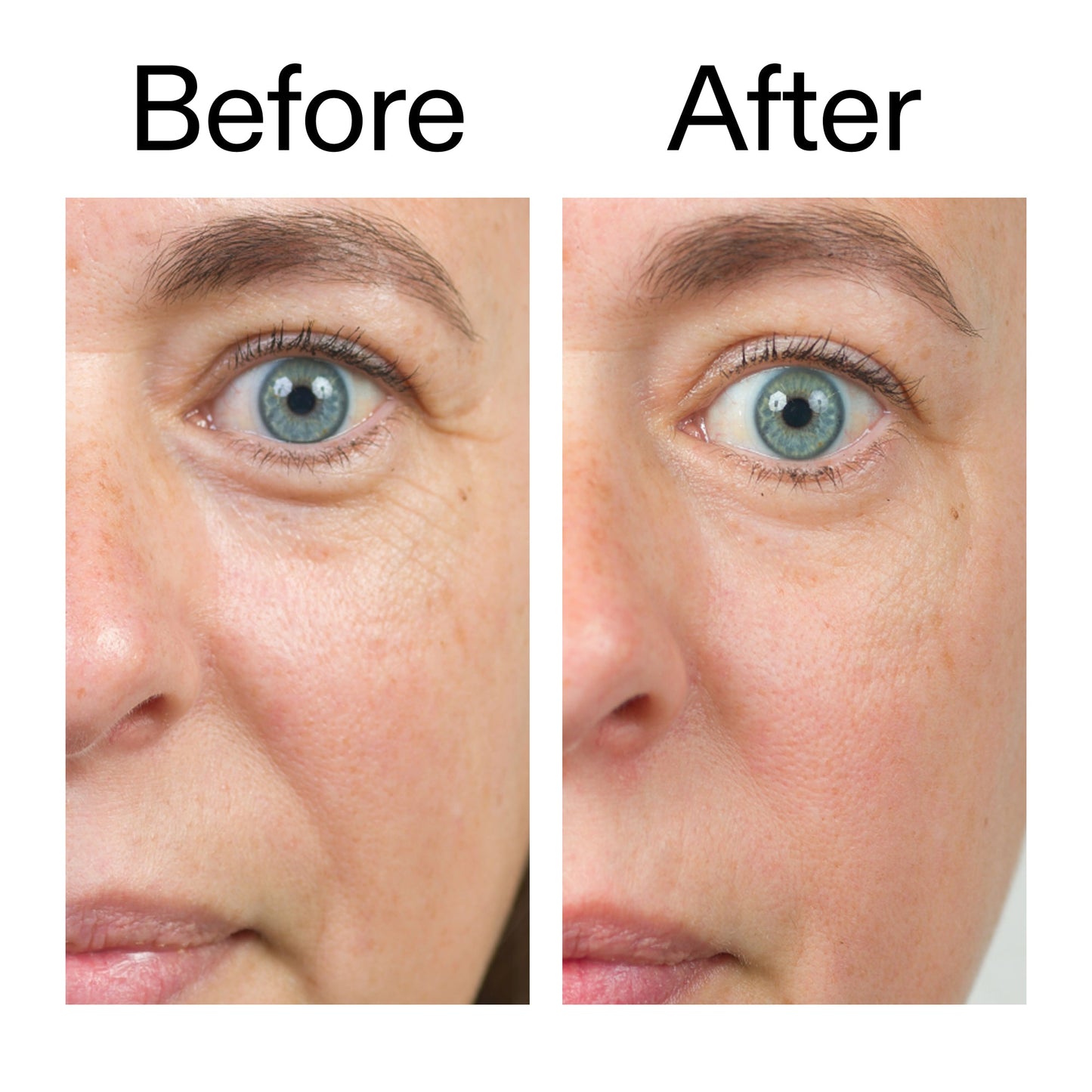 bio-active-ceramide-moisturizer-duo-k5 Bio-Active_Before_After_2000x2000_566e5a9e-135e-417a-8242-b44e5fa35463.jpg