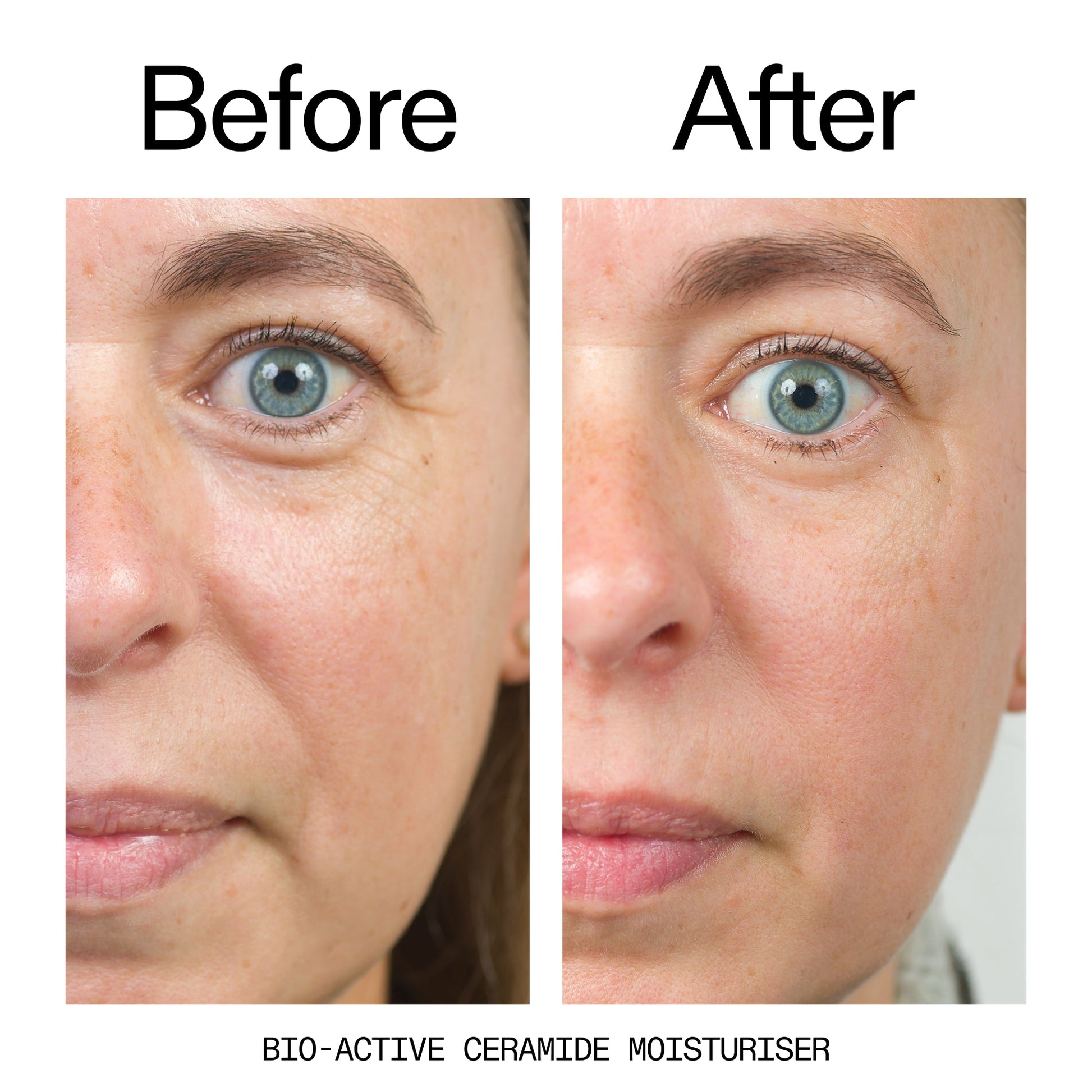 barrier-boosting-trio-s6 Bio-Active_Before_After_2000x2000_600947b4-e8c5-425a-9155-fc15bc83aa12.jpg