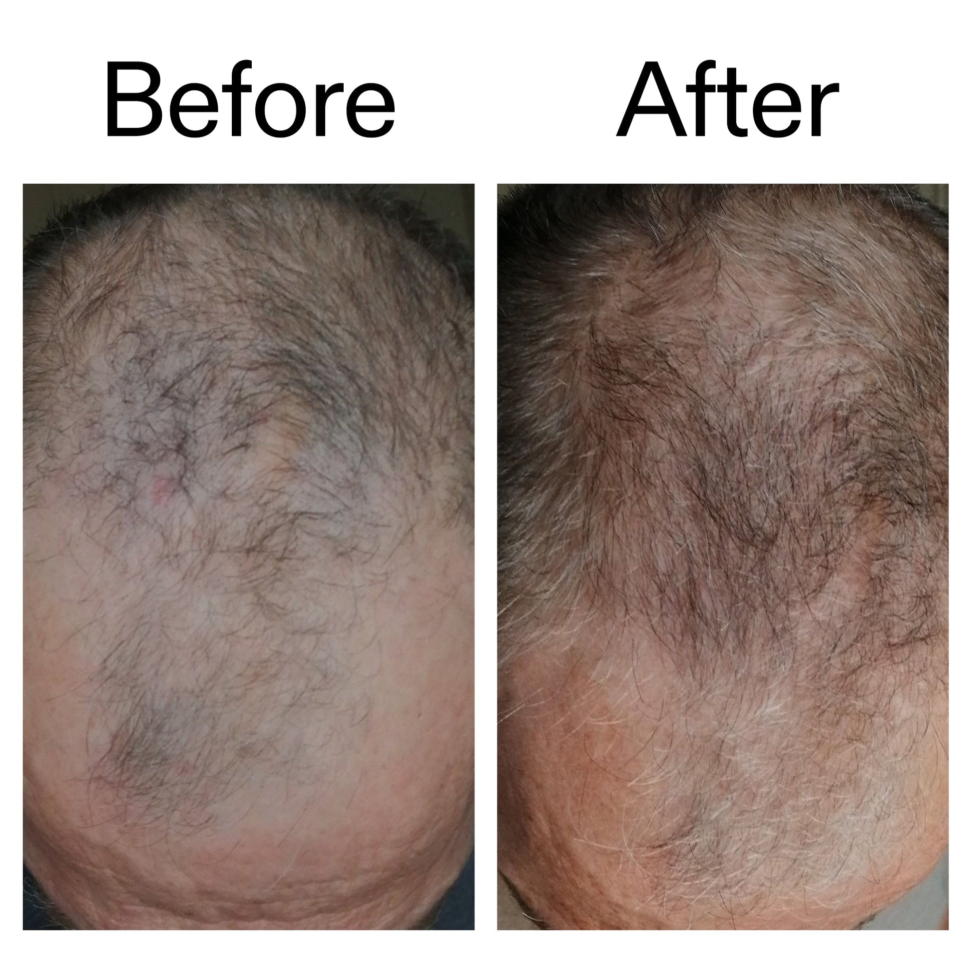 3-month-hair-growth-trio-o4 Caffeine_Scalp_Treatment_B_A_Ppage_2000_x_2000.jpg