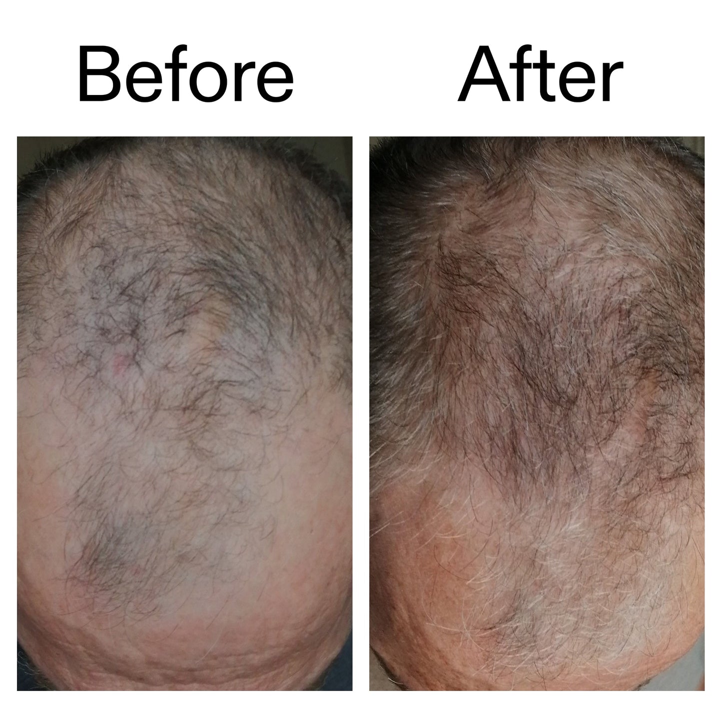 caffeine-stimulating-scalp-treatment-x9 Caffeine_Scalp_Treatment_B_A_Ppage_2000_x_2000.jpg