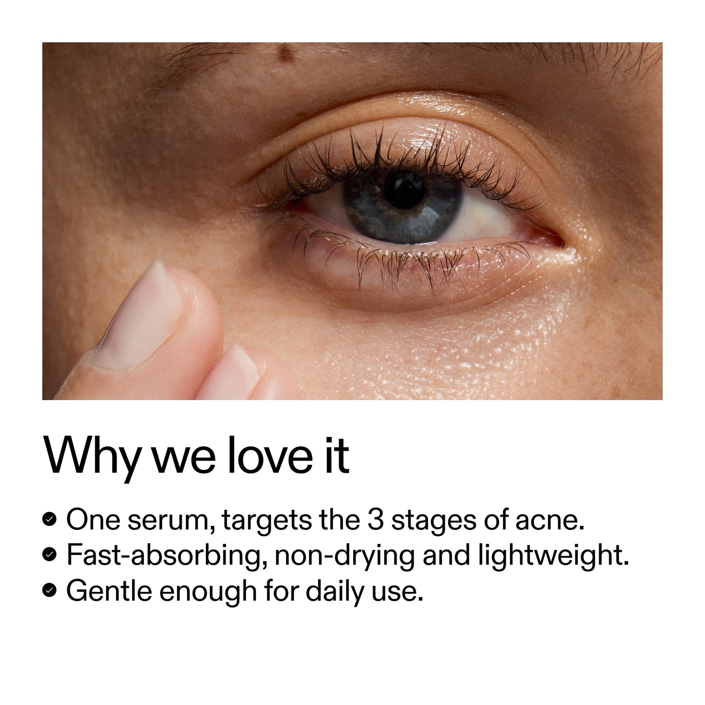 360-acne-clearing-duo-m8 Dioic_Whyweloveit_2000x2000_175aafd3-0cbe-403a-b317-a8362881bfe2.jpg