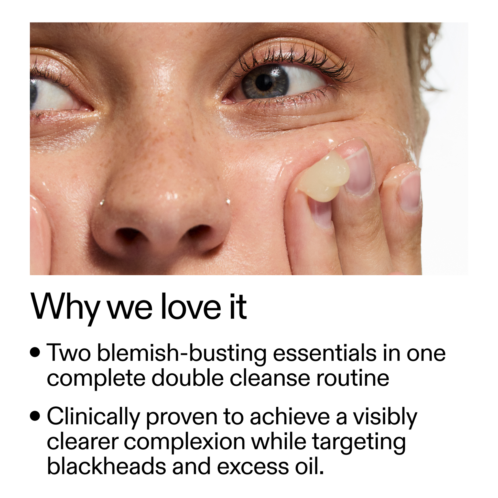 acne-double-cleanse-duo-z3 Double_Cleanse_Duo_for_Breakouts_Why_We_2000x2000_f242cb12-bb5c-487c-b203-071ccb406ec5.png