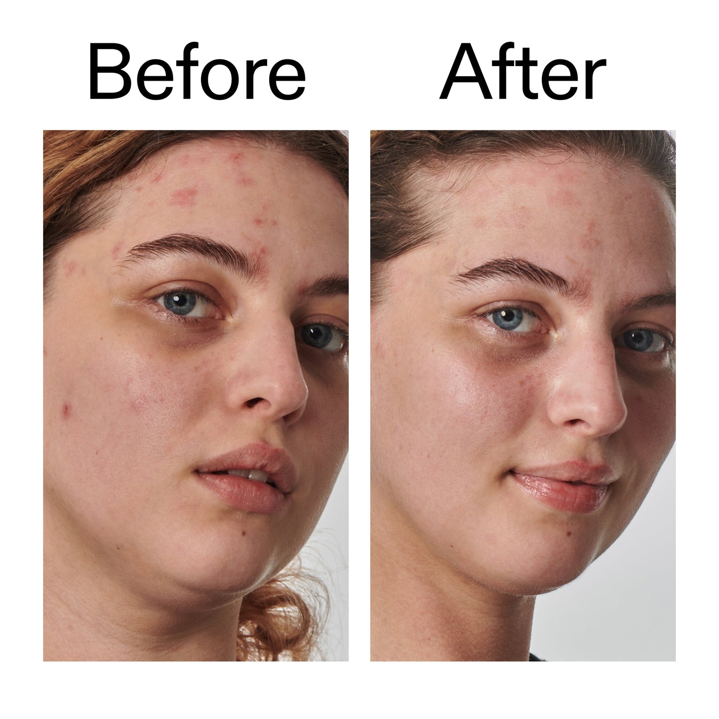 10-urea-moisturizer-r5 Dry_and_Rough_Skin_Solution_Before_After_2000x2000_efa6e639-5c39-49bd-a5dd-f0220293120a.jpg