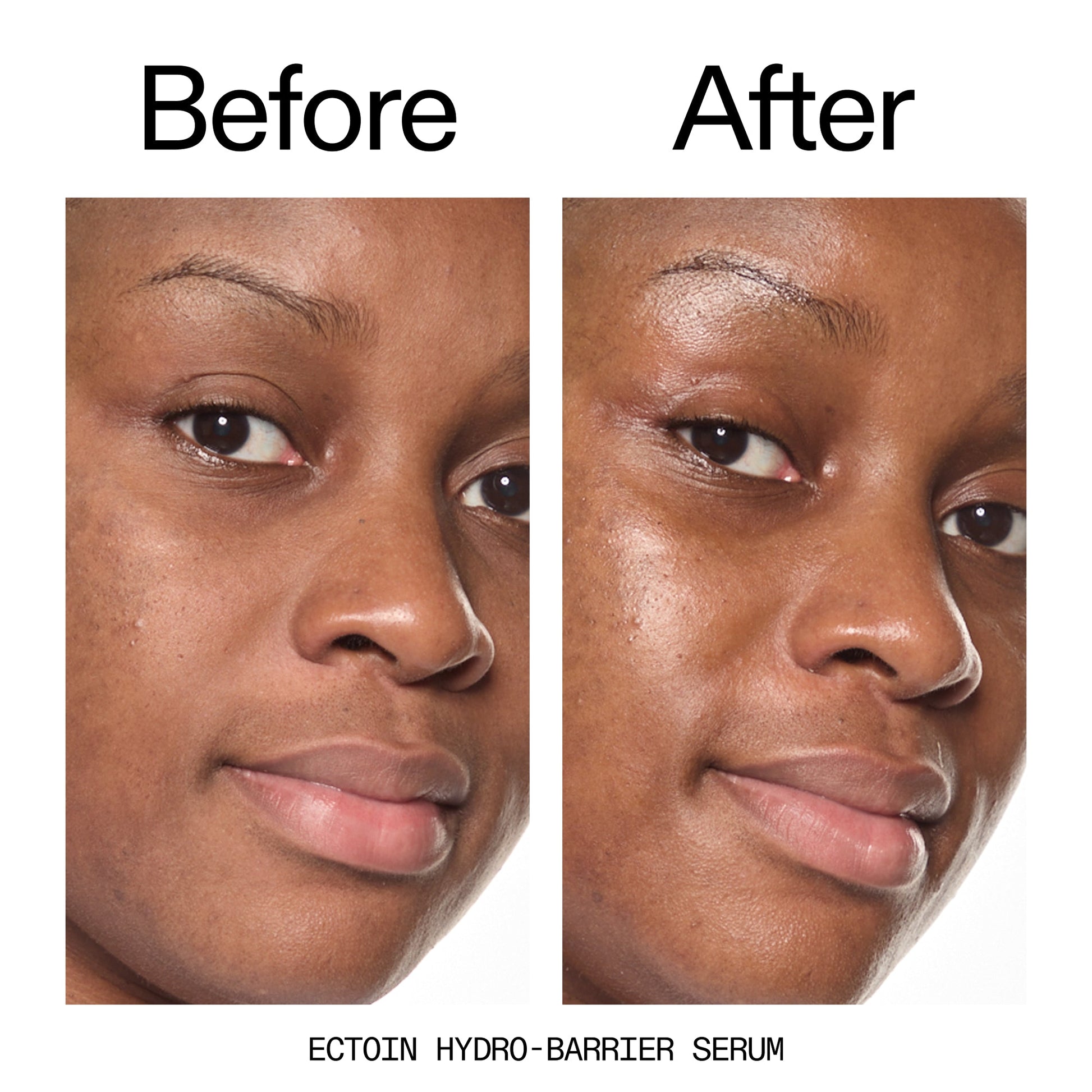 barrier-boosting-trio-s6 Ectoin_Before_After_2000x2000_ce35bc41-4da0-4b6f-adc7-29f8641f6c6c.jpg