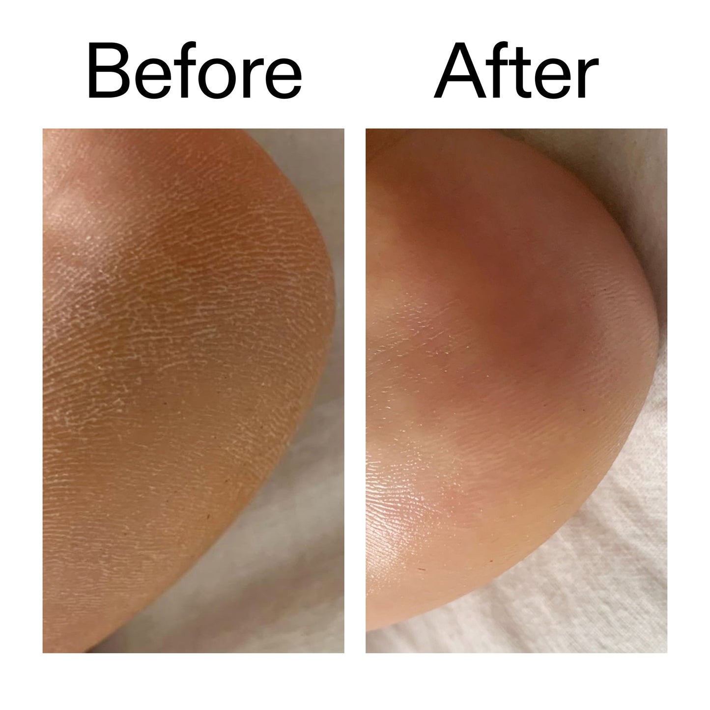 glycolic-acid-exfoliating-body-stick-z5 Glycolic_Acid_Exfoliating_Body_Stick_Before_After_V1_2000x2000_a3043625-9400-429a-a7fb-d6dbd220f722.jpg