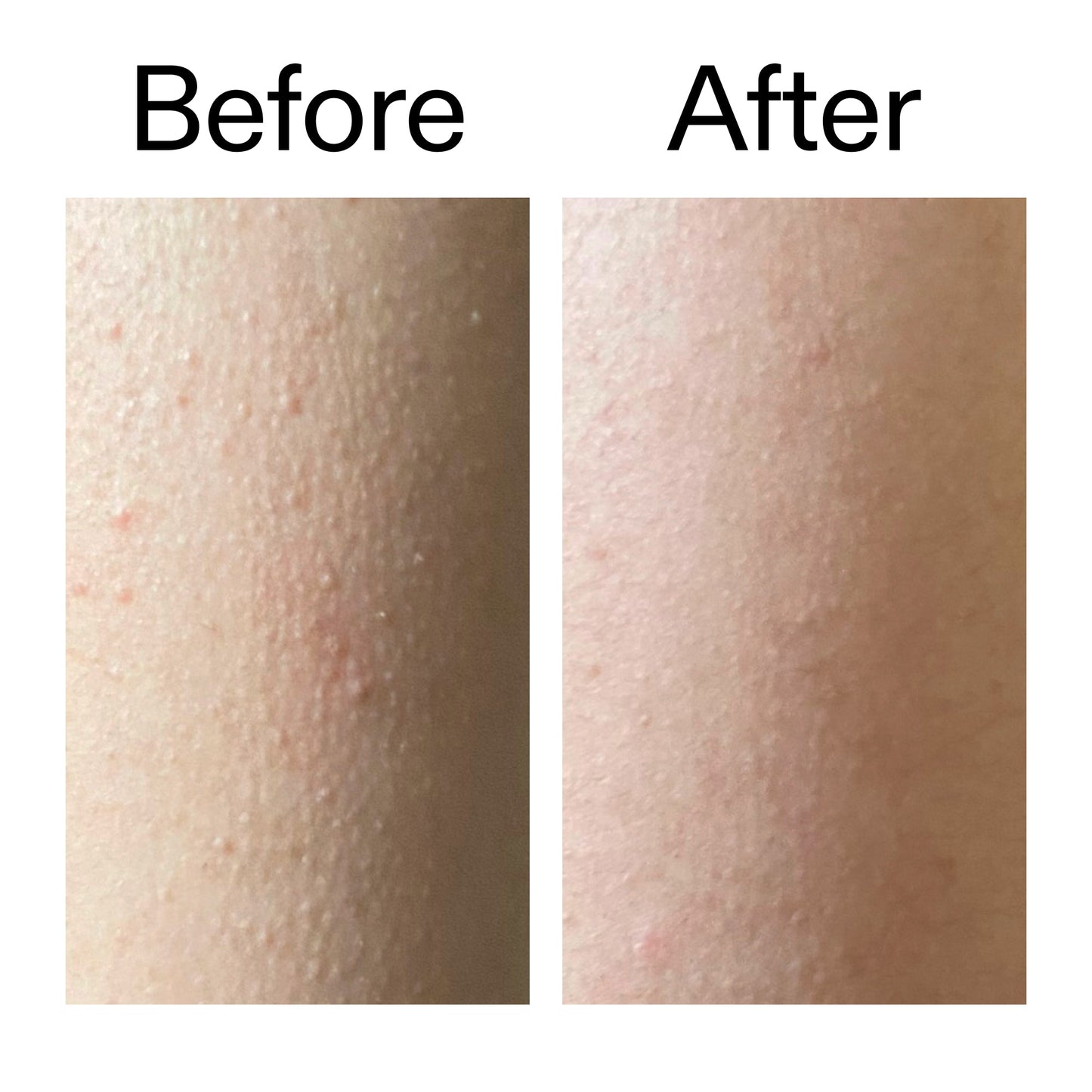 glycolic-acid-exfoliating-body-stick-z5 Glycolic_Acid_Exfoliating_Body_Stick_Before_After_V2_2000x2000_2e4ba052-94f6-4d56-82df-7bdb5b2df7ae.jpg