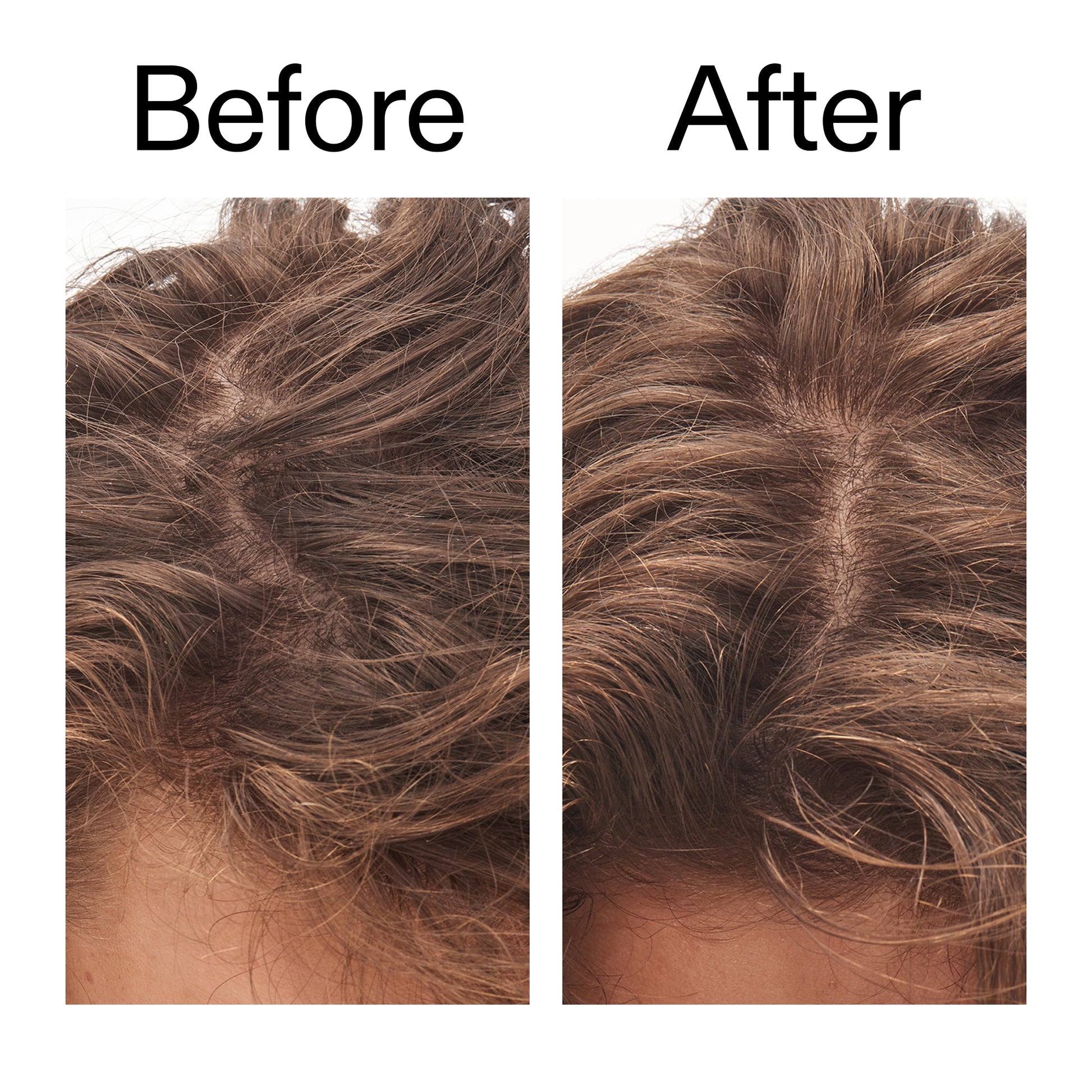 glycolic-acid-exfoliating-scalp-scrub-i8 Glycolic_Acid_Exfoliating_Scalp_Scrub_Before_After_2000x2000_b8561c87-05a1-4caa-80f7-1b6b33d750f7.jpg
