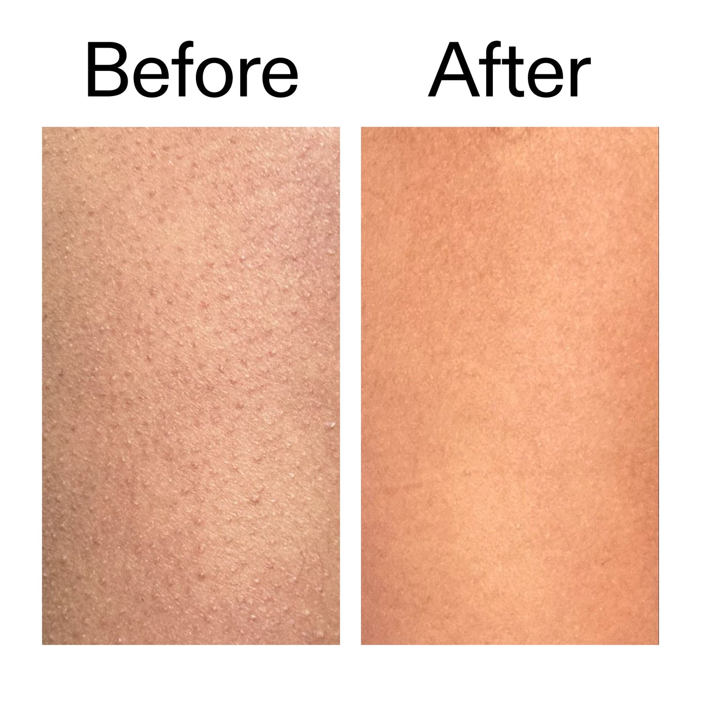 glycolic-acid-exfoliating-body-stick-z5 Glycolic_Body_Stick_B_A_2000x2000_6e6e6b4d-5bd7-43c0-aeed-4d66788e8995.jpg