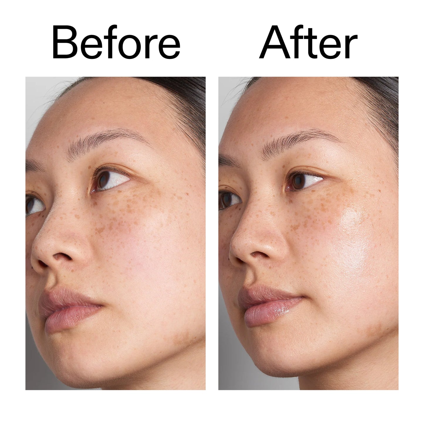 hyaluronic-acid-serum-60ml-s0 Hyaluronic_Acid_Before_After_2000x2000_d7983956-8aa2-4ea3-8255-c63e8d4f892e.jpg