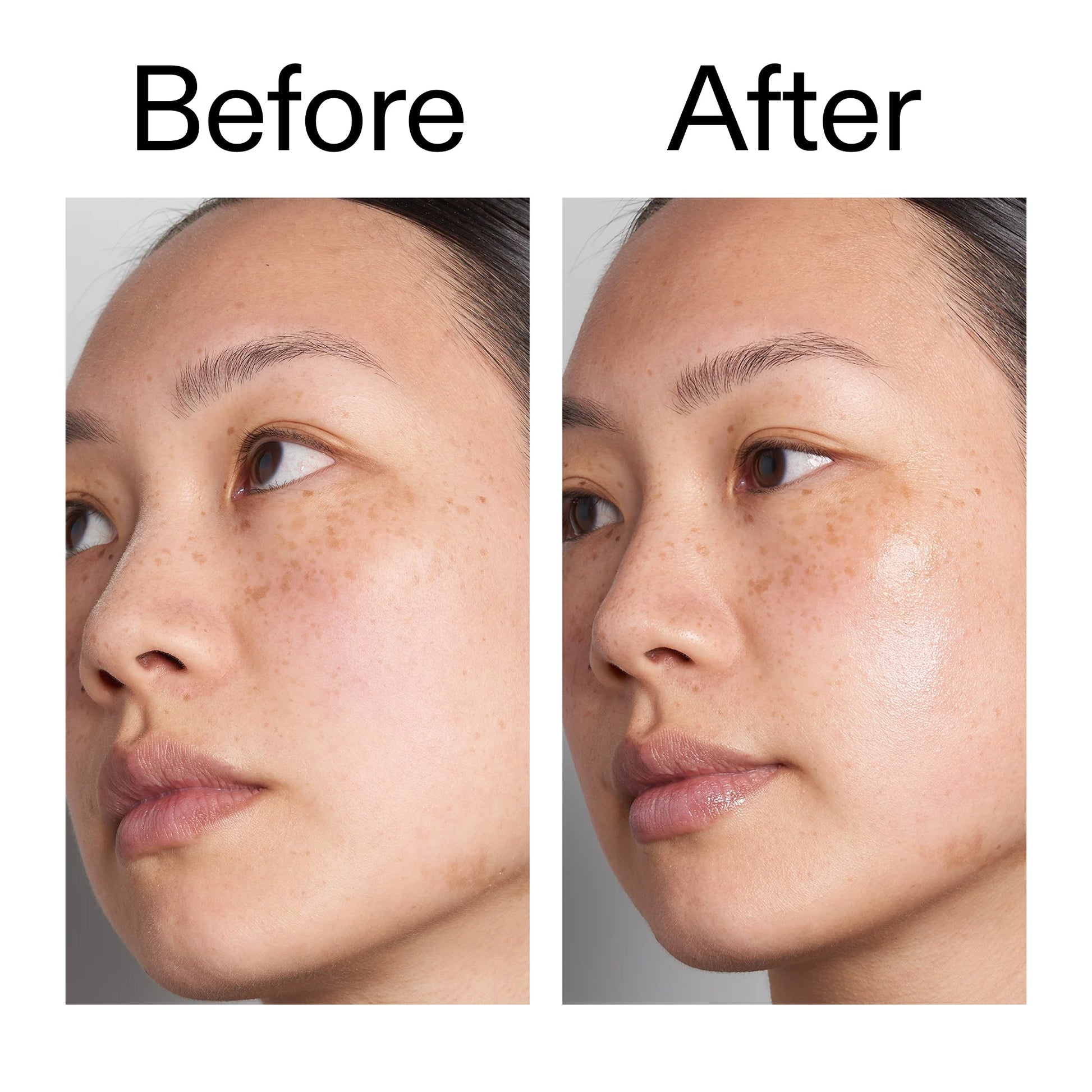 supersize-hyaluronic-acid-serum-100ml-r8 Hyaluronic_Acid_Before_After_2000x2000_d7983956-8aa2-4ea3-8255-c63e8d4f892e.jpg