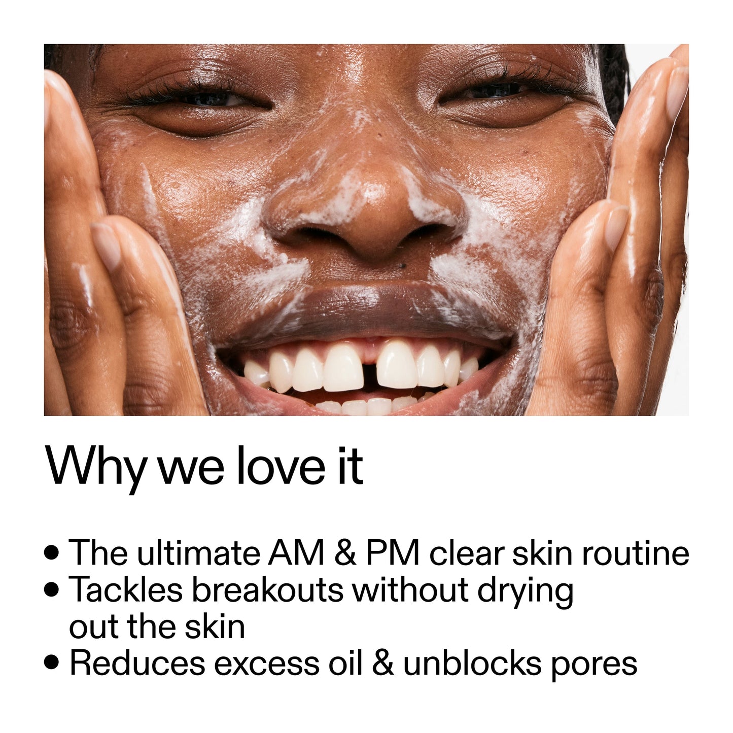 intro-routine-for-acne-w8 Intro_Routine_for_Acne_Why_we_love_it_2000x2000_42499e10-4629-4a0e-a627-7e215f4da6bc.jpg