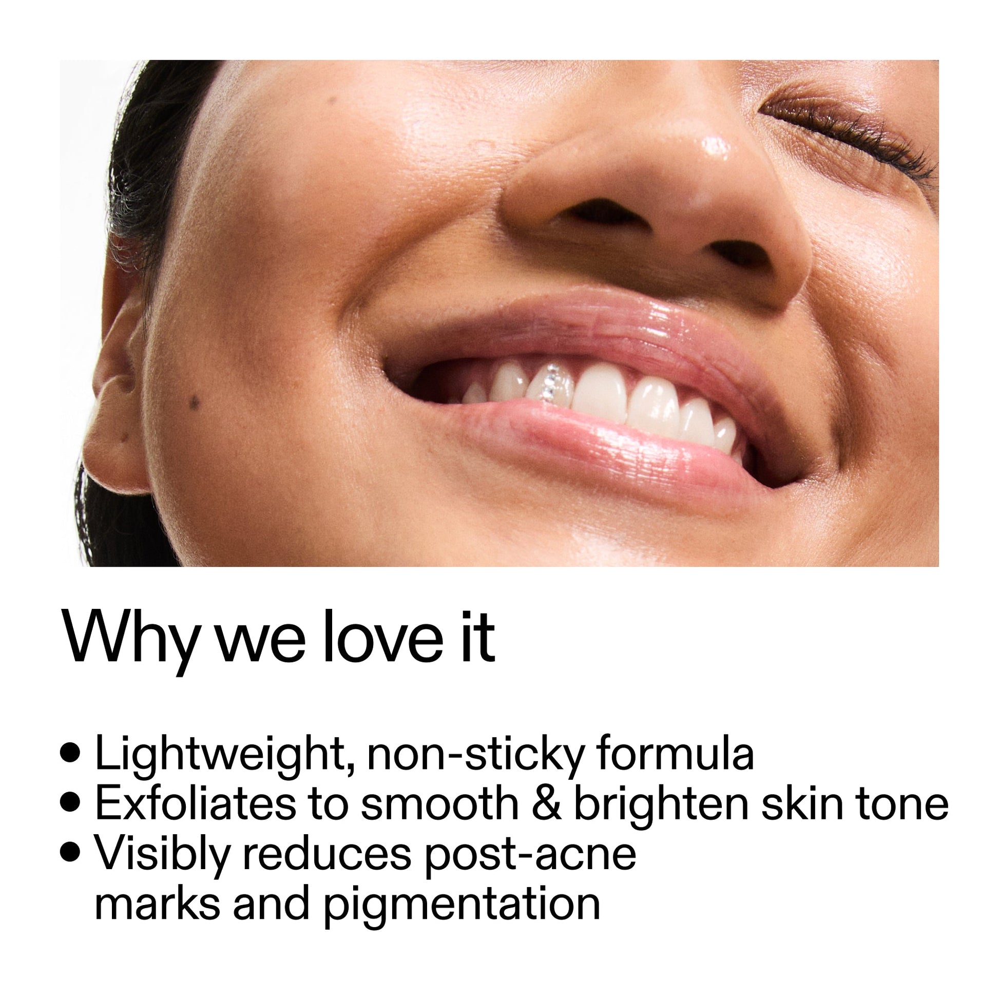 mandelic-acid-treatment-z5 Mandelic_Acid_Treatment_Why_we_love_it_2000x2000_6dfe29a9-2a79-464f-a5e8-e5ac37d93388.jpg