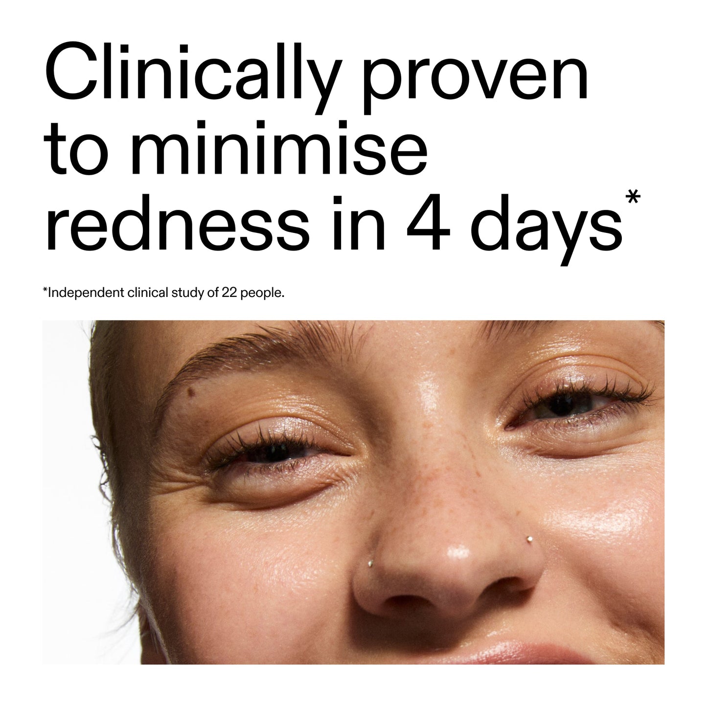 10-azelaic-acid-serum-for-redness-relief-c8 Oat_Cleansing_Balm_Claim_2000x2000_52a841dc-353c-4f2c-8646-3aadb604507d.jpg