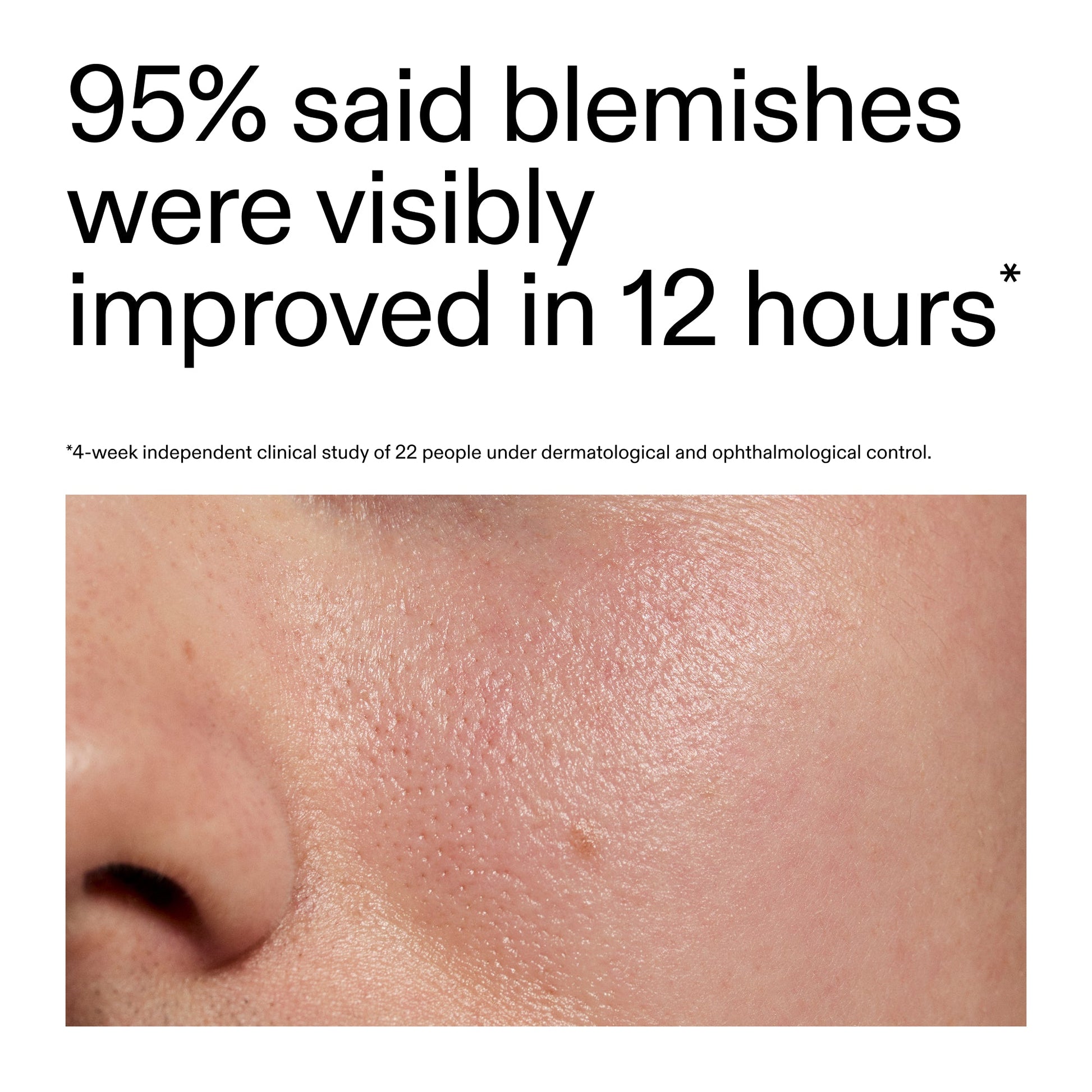 succinic-acid-acne-treatment-q0 Oat_Cleansing_Balm_Claim_2000x2000_ac6ce553-25db-41b2-a981-faae1ac4b8c0.jpg