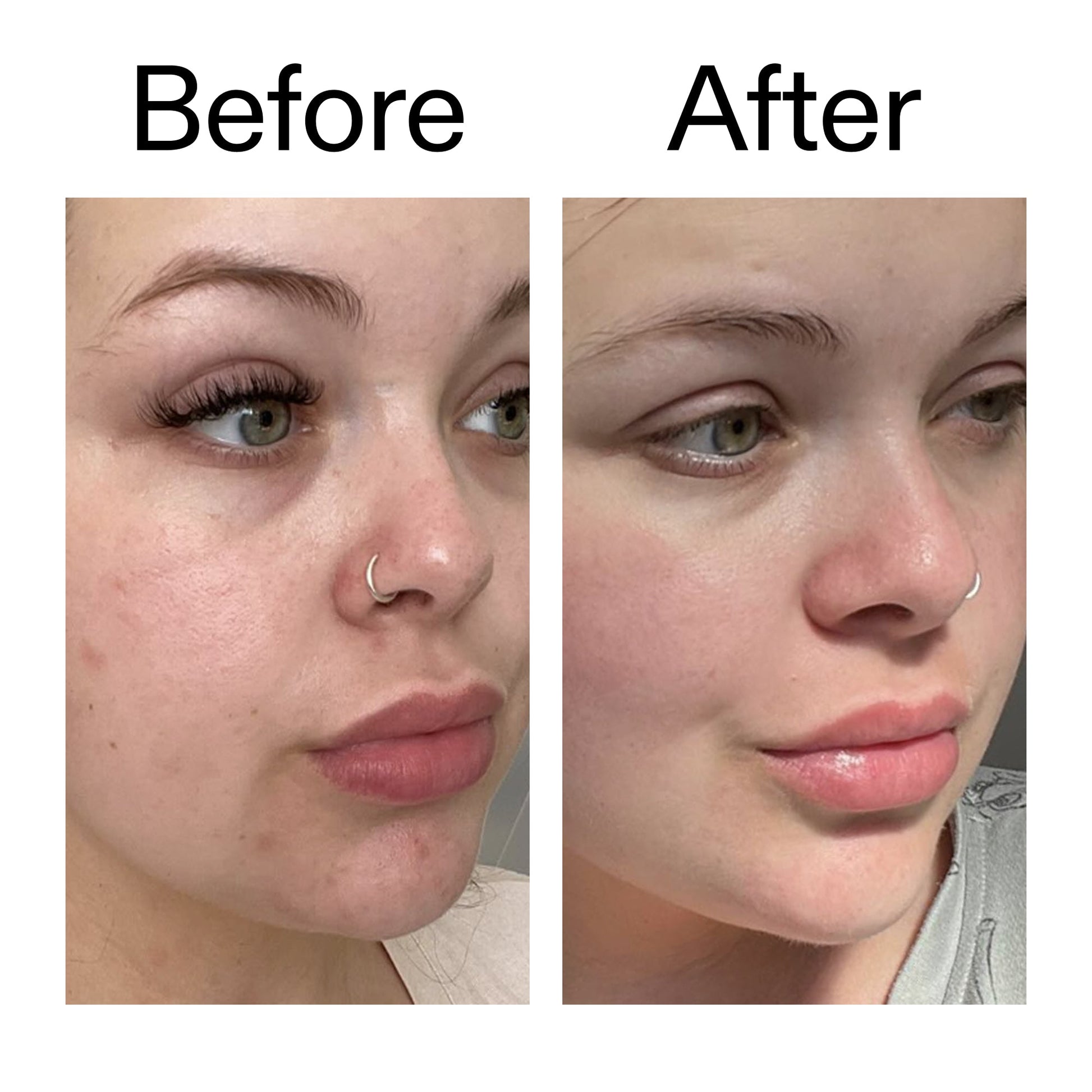 omega-water-cream-50ml-g0 Omega50_Before_After_2000x2000_46483ed8-3f9d-487f-9a0c-9df79830bd65.jpg