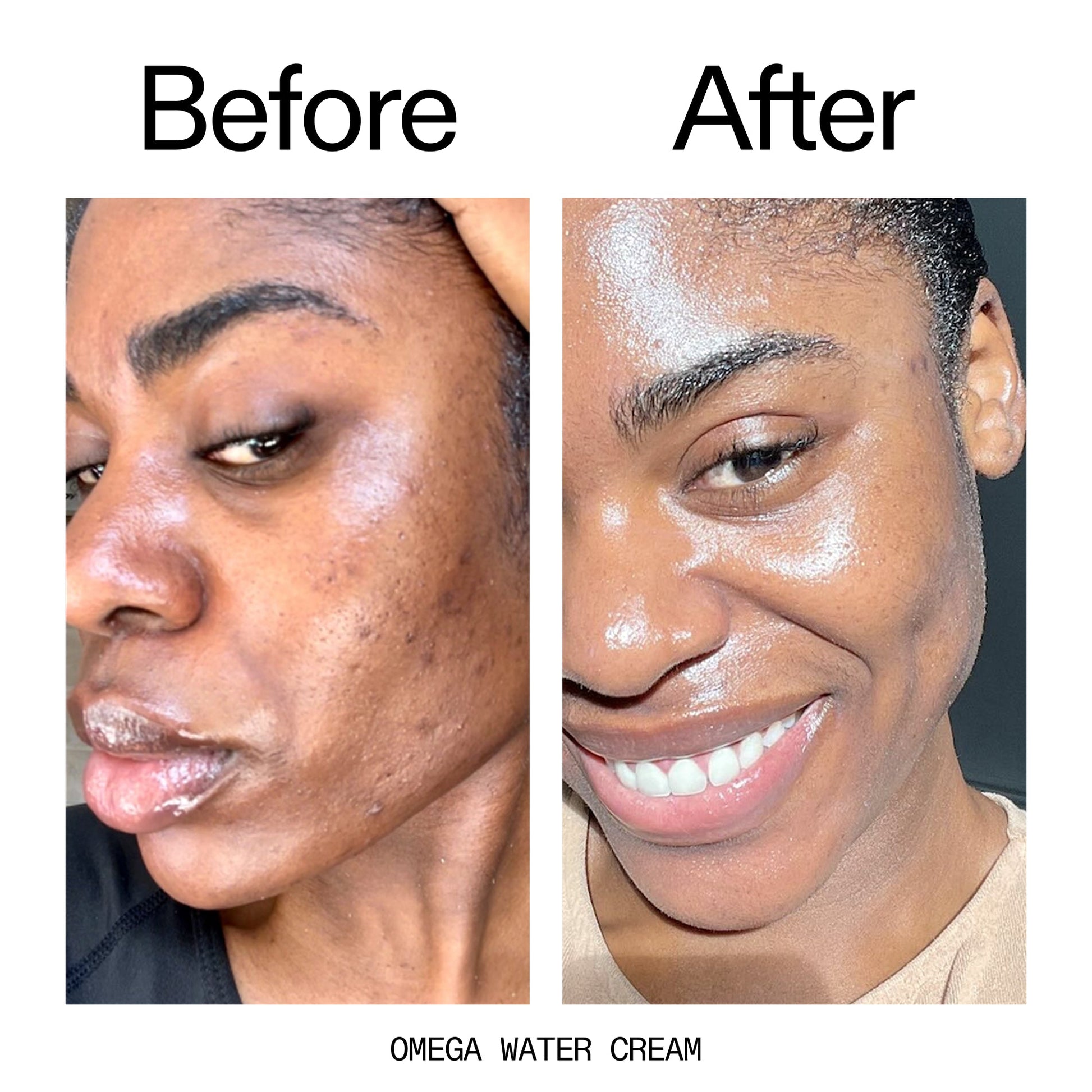 glowing-skin-set-m2 Omega_Water_Cream_Before_After_2000x2000_8e88278b-8c8d-48dc-ac77-4e98ebbd1b77.jpg
