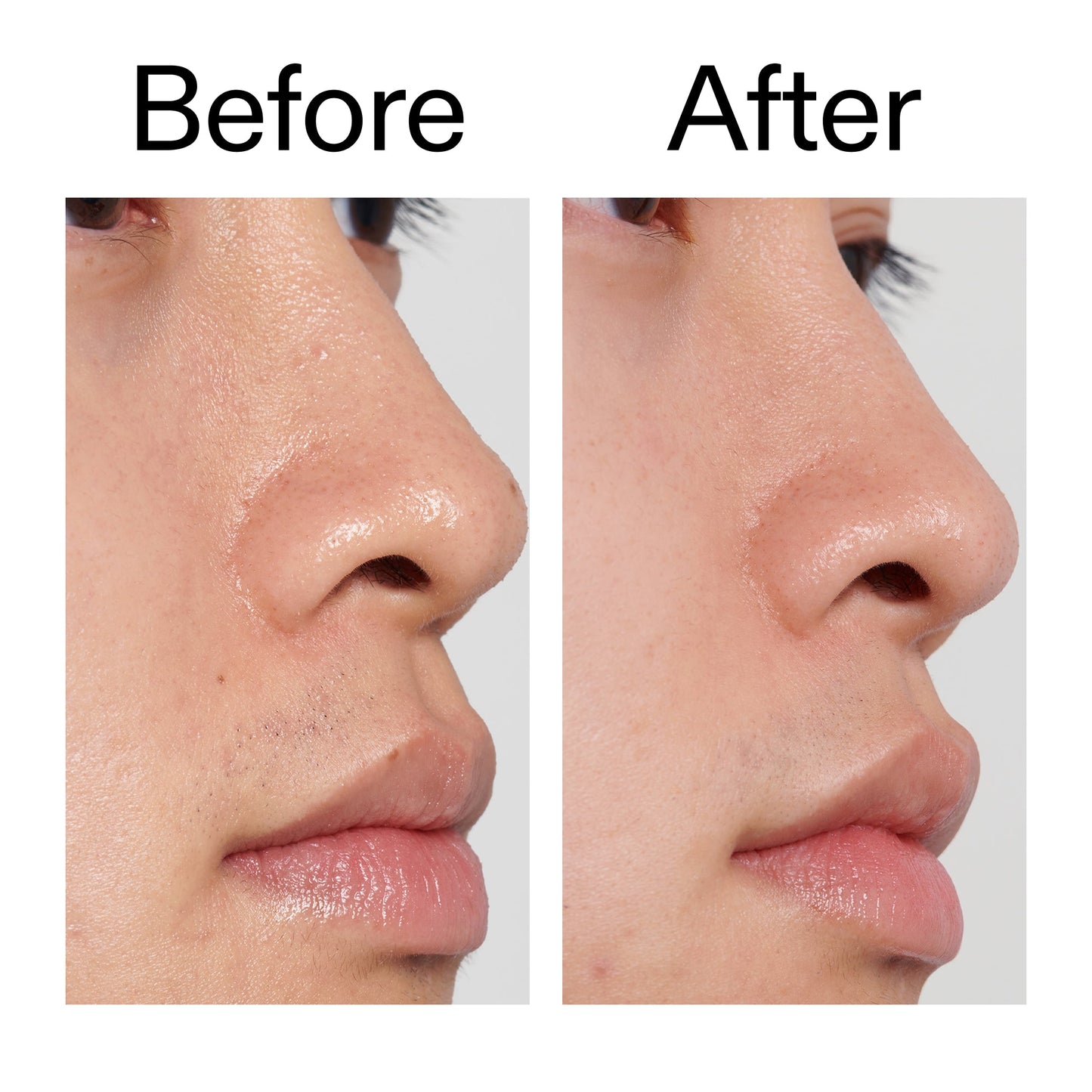 pha-toner-p3 PHA_Toner_Before_After_2000x2000_e3c10172-0150-4342-8b95-57417eaff50d.jpg