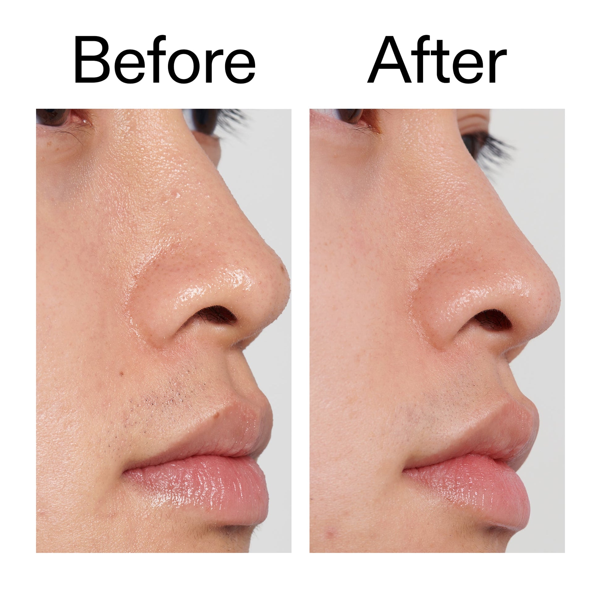 pha-toner-p3 PHA_Toner_Before_After_2000x2000_e3c10172-0150-4342-8b95-57417eaff50d.jpg