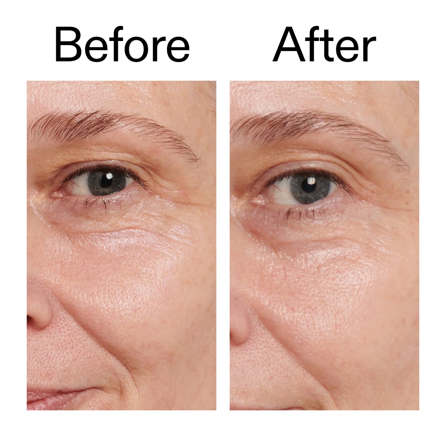retinol-eye-cream-v7 Retinol_Eye_Cream_Before_After_2000x2000_ac03a80c-109e-4572-a95a-91dc109b4d27.jpg