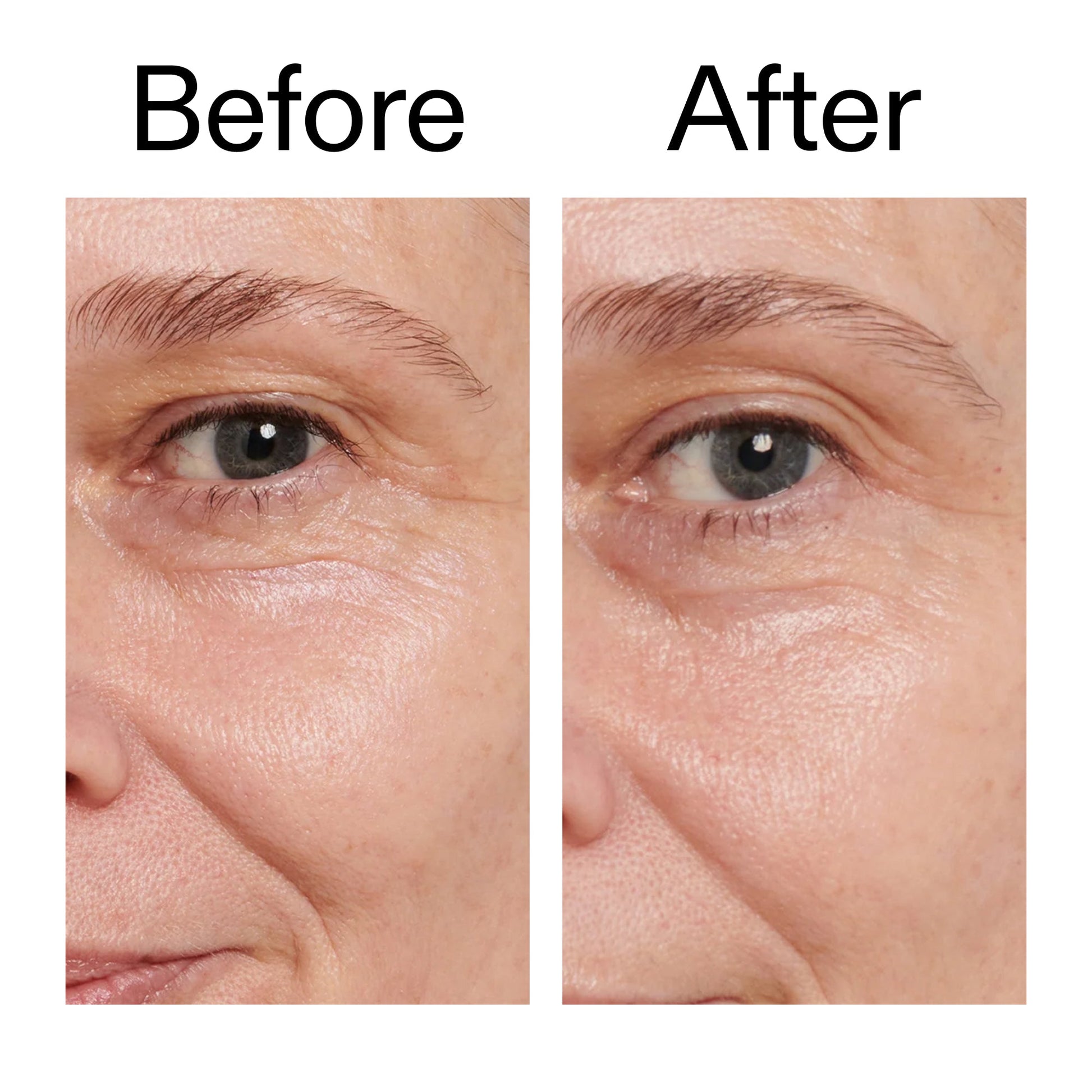 retinol-eye-cream-v7 Retinol_Eye_Cream_Before_After_2000x2000_ac03a80c-109e-4572-a95a-91dc109b4d27.jpg
