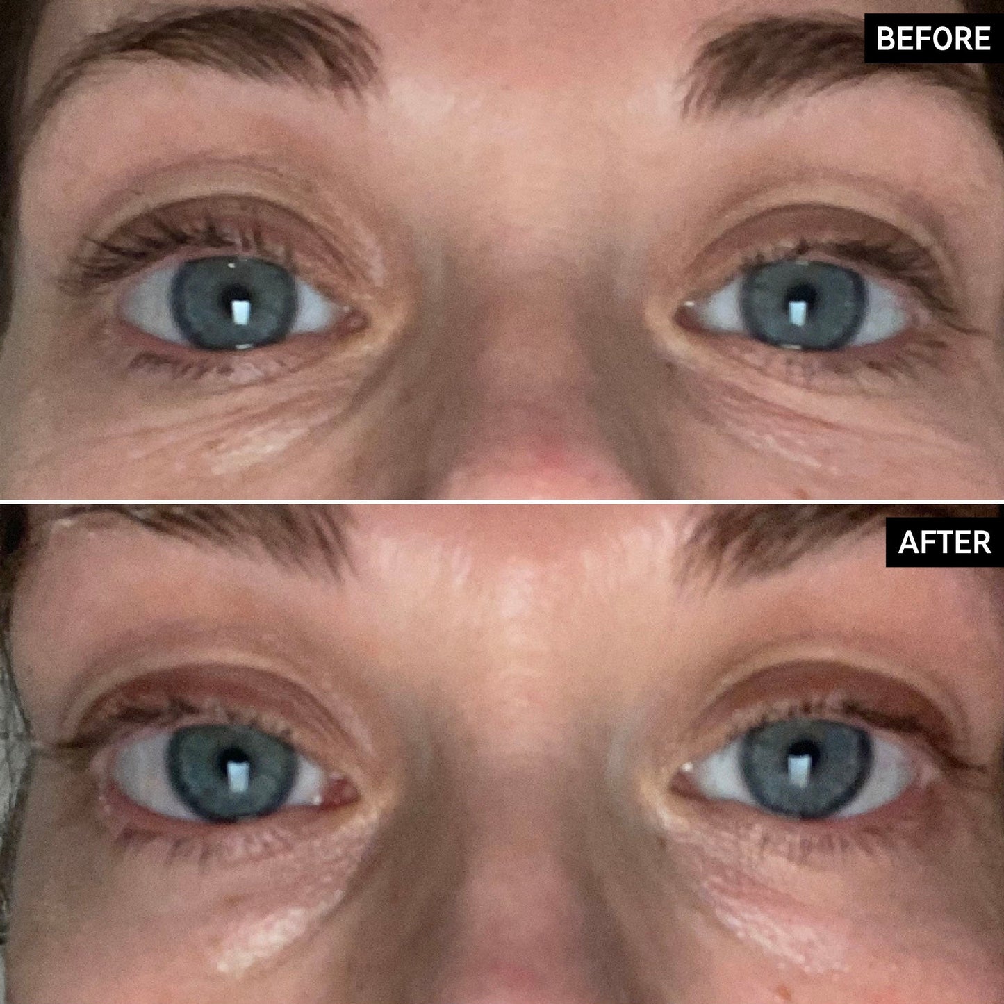 retinol-eye-cream-v7 SITE-UGCBAsApril_Nicole_B_A_PPage_2000x2000_1.jpg