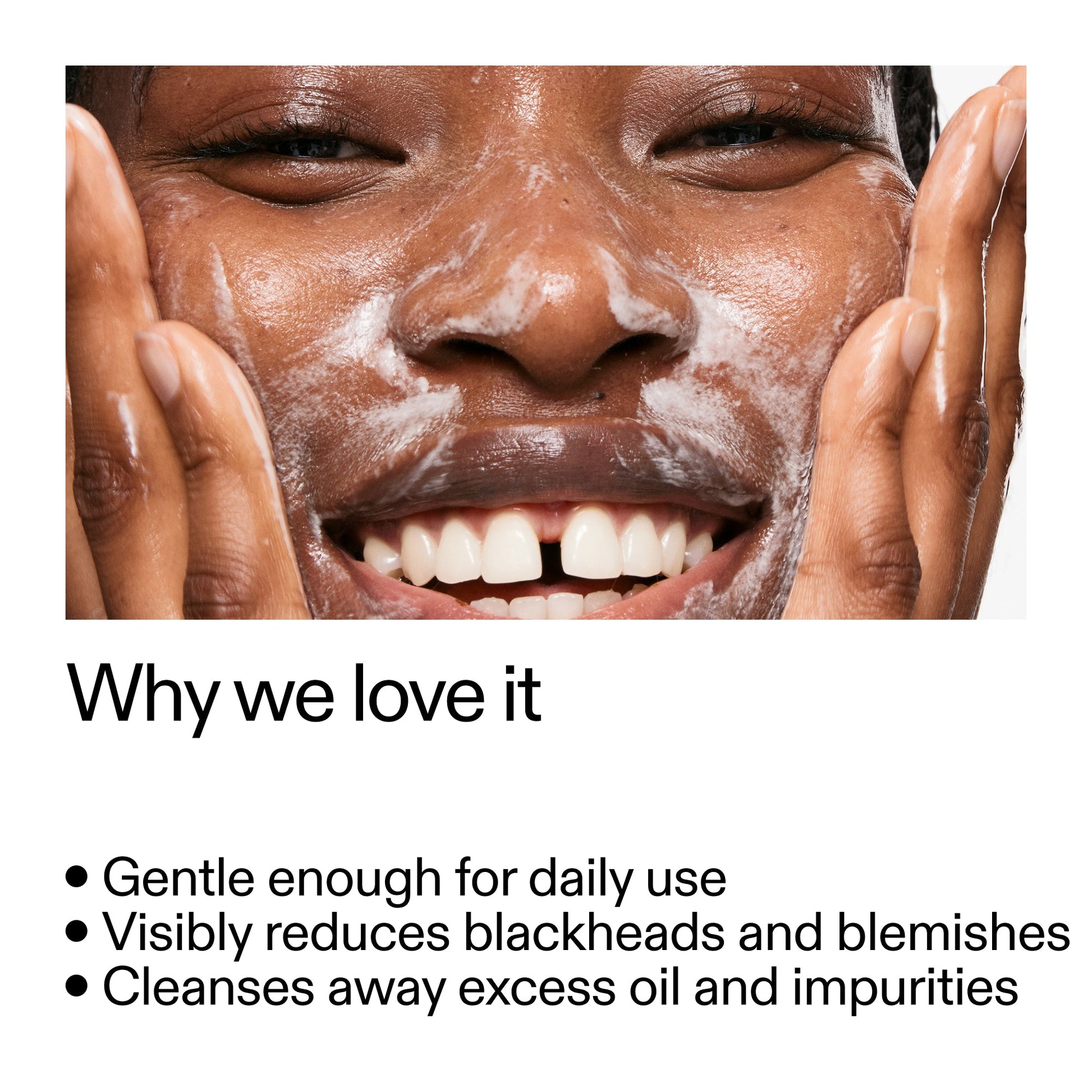 salicylic-acid-cleanser-150ml-r5 Salicylic_Acid_Cleanser_-_300mlWhy_we_love_it_2000x2000_87dc92a9-2559-4309-98cd-4e570f1be735.jpg