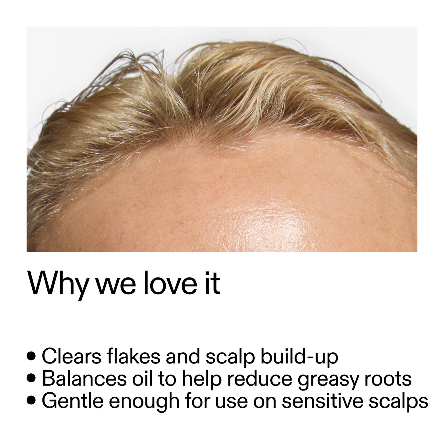 salicylic-acid-exfoliating-scalp-treatment-p3 Salicylic_Acid_Exfoliating_Scalp_Treatment_Why_we_love_it_2000x2000_44b6bd6d-9ec4-4b23-9dc4-bc3fd6f28e14.jpg