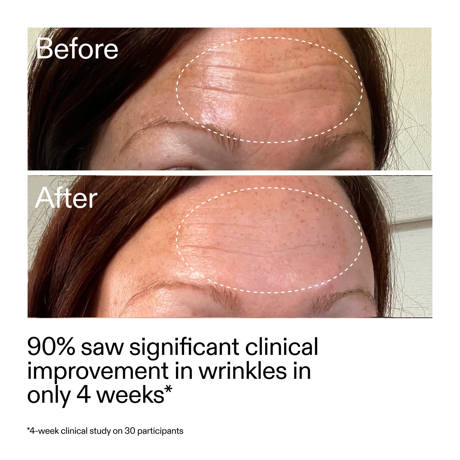 starter-retinol-serum-duo-v8 StarterRetinol_BeforeAfter_Claim1_2000x2000_03b4d6e5-a357-43b9-a855-aba5e35c57f3.jpg