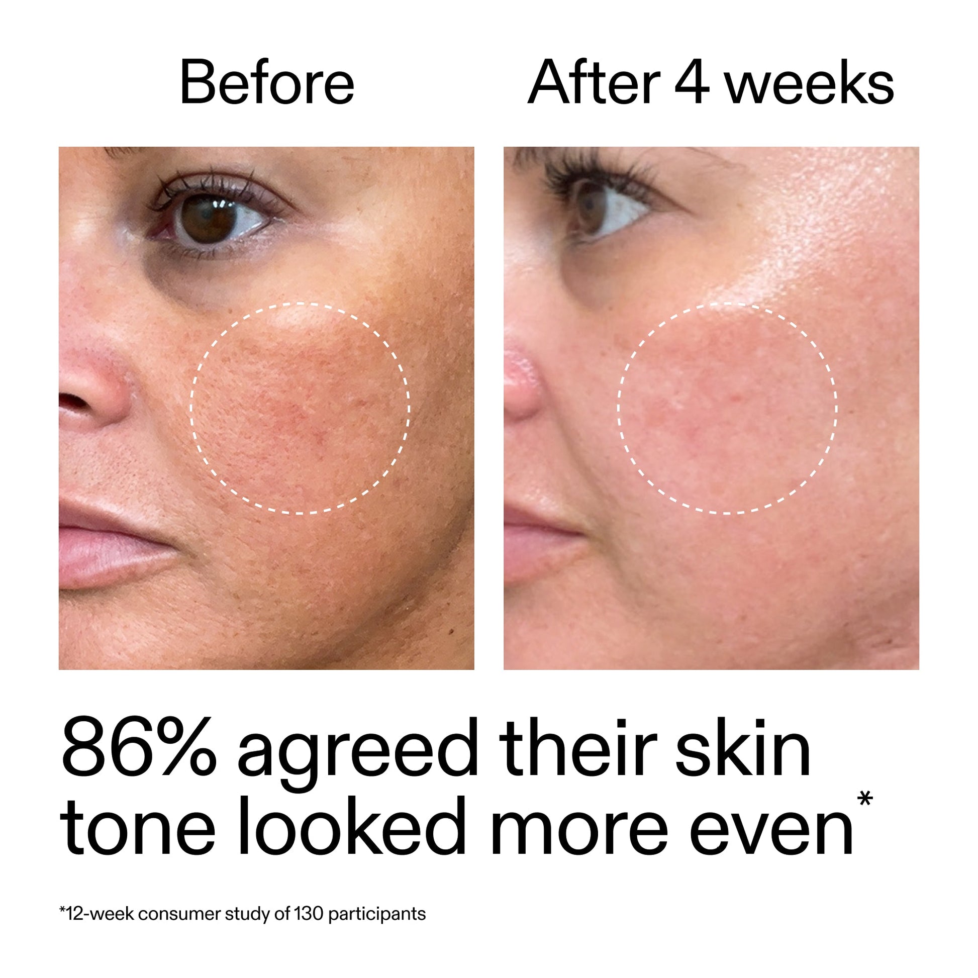 starter-retinol-serum-duo-v8 StarterRetinol_BeforeAfter_Claim2_2000x2000_fc5bb8ac-8588-478f-98d5-28af6651601a.jpg
