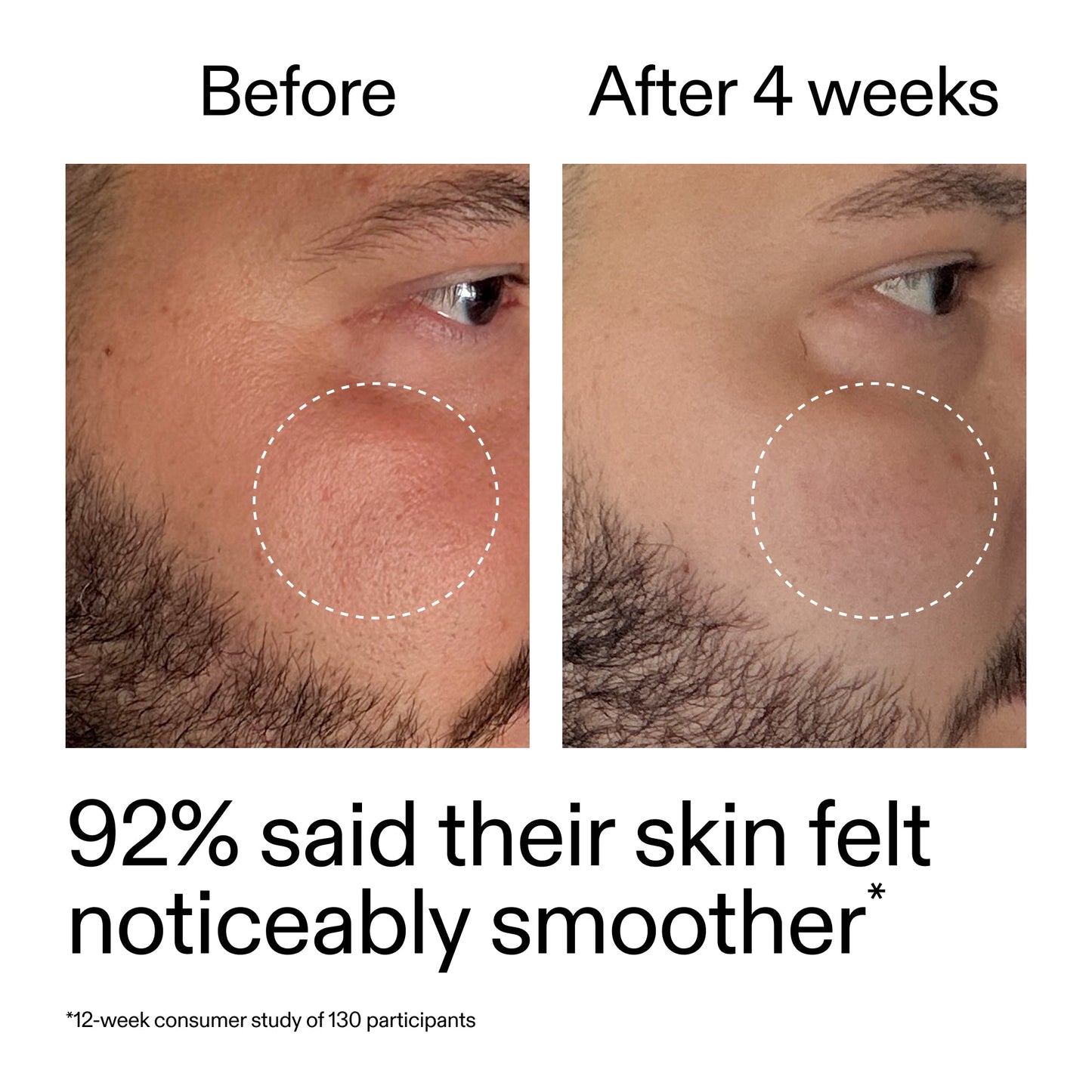 starter-retinol-serum-duo-v8 StarterRetinol_BeforeAfter_Claim3_2000x2000_458243a8-bbb0-4e5d-a274-29c7766d339b.jpg