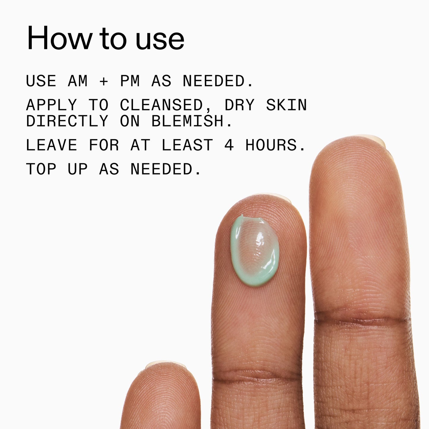 succinic-acid-acne-treatment-q0 Succinic_Acid_Treatment_How_to_Use_2000x2000_d57137d5-d7f1-427c-9a46-5fc00c19c542.jpg
