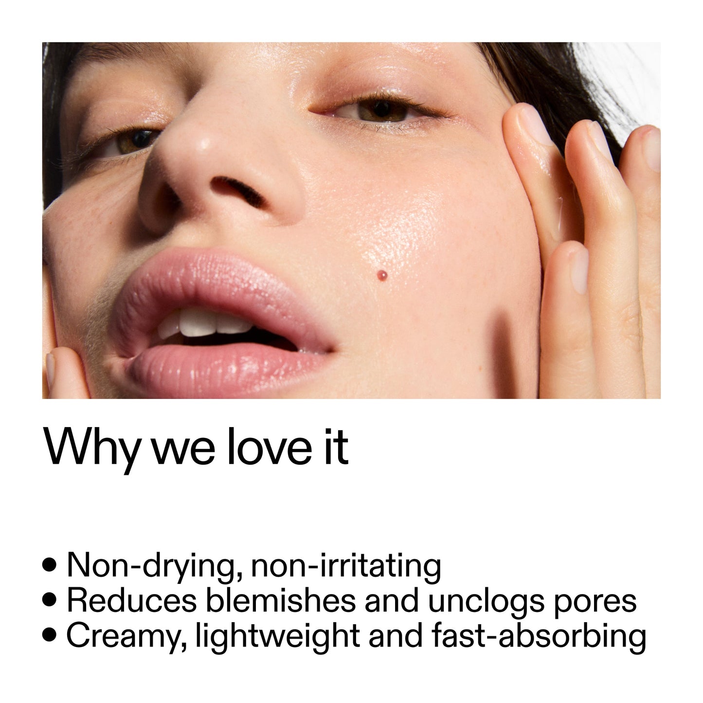 succinic-acid-acne-treatment-q0 Succinic_Acid_Treatment_Why_we_love_it_2000x2000_e90dd42a-cfe9-48b5-a2c7-d5eda787a6a8.jpg