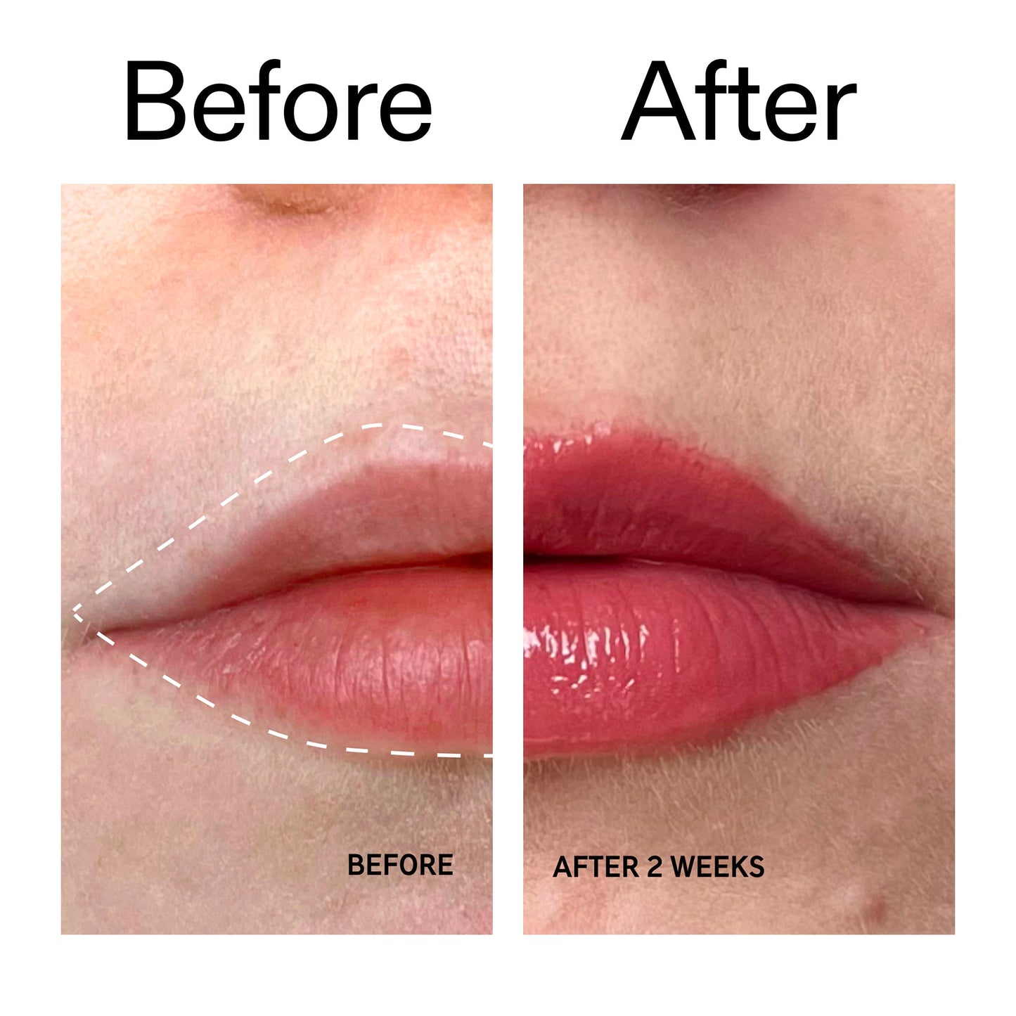 tripeptide-plumping-berry-lip-balm-a7 Tripeptide_Plumping_Lip_Balm_-_Berry_Before_After_2000x2000_9474bbd8-43ca-4b0e-b0e7-dfab70b91927.jpg