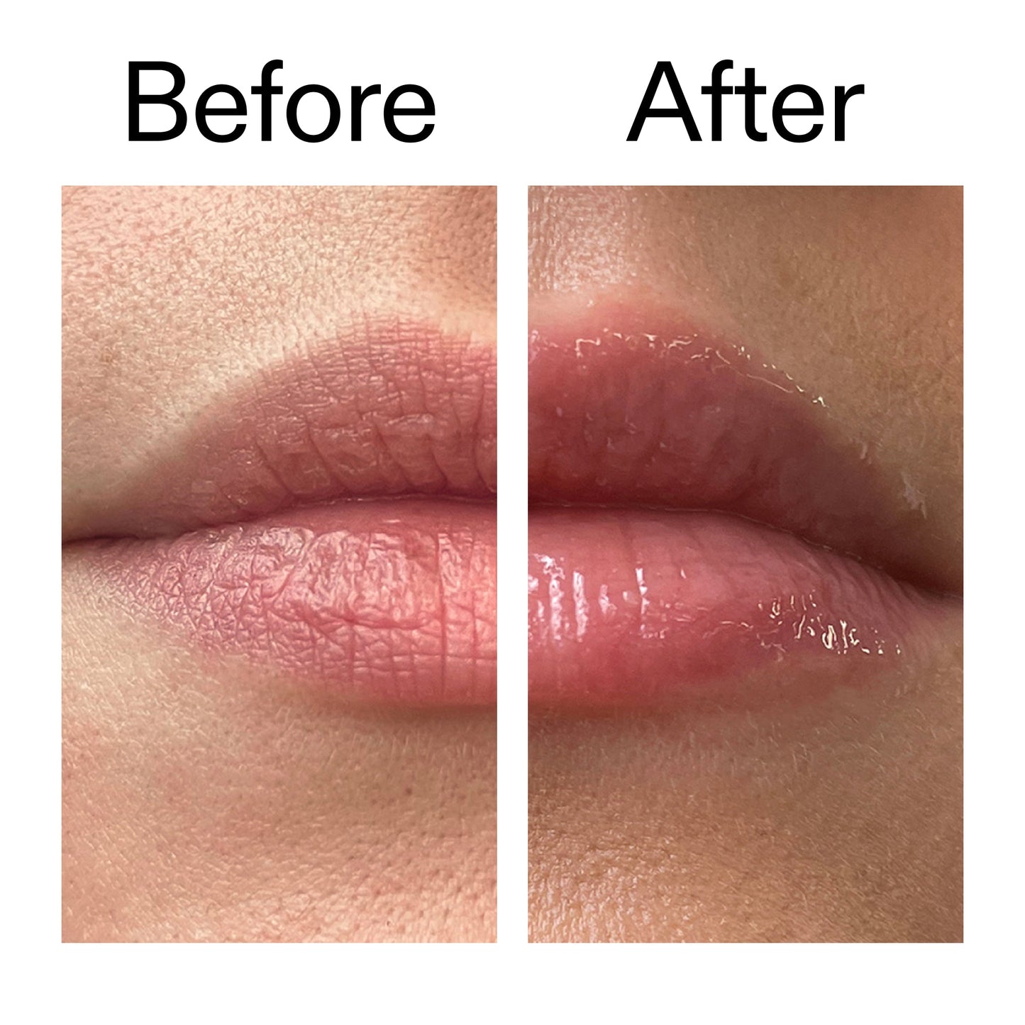 tripeptide-plumping-lip-balm-o3 Tripeptide_Plumping_Lip_Balm_Before_After_2000x2000_b4a5ee04-d2ac-4857-8f01-17209acc4bf3.jpg
