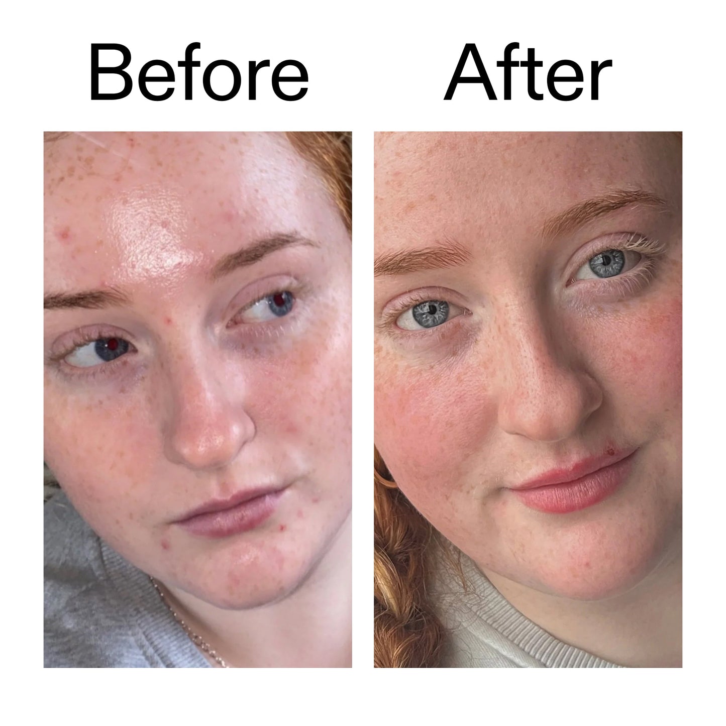 vitamin-b-c-and-e-moisturizer-k1 Vitamin_B_C_and_E_Moisturizer_Before_After_2000x2000_b0781a76-5ad2-4be9-95b8-ef92b356833c.jpg